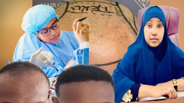 {DAAWO MUQAALKA} Maxaa ka taqanaa Gabadha timaha u beerto ragga Muqdisho ?