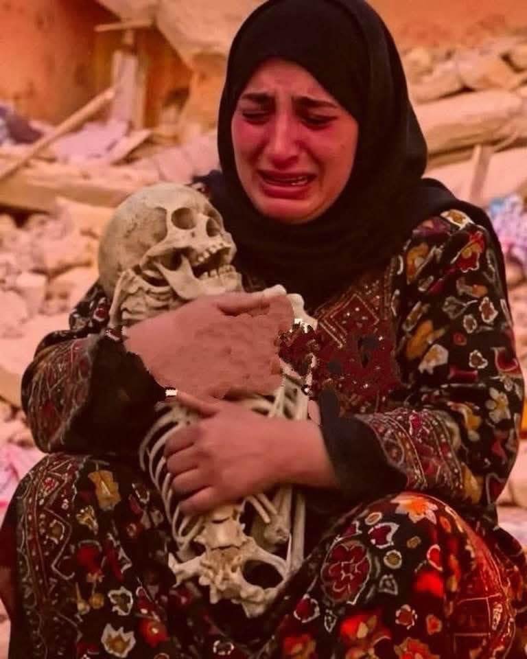 Dhacdo Xanuun Badan oo ka Dhacday Magaalada Gaza