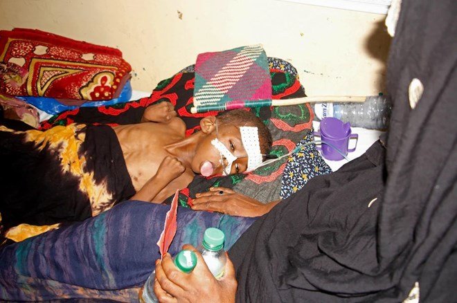 US aid kept many hungry Somali children alive. Now that money is disappearing.