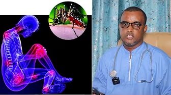 {DAAWO MUUQAALKA} Maxaa keena Cudurka Kaduudiyaha, Maxaana la gudboon qofka uu ku dhaco?